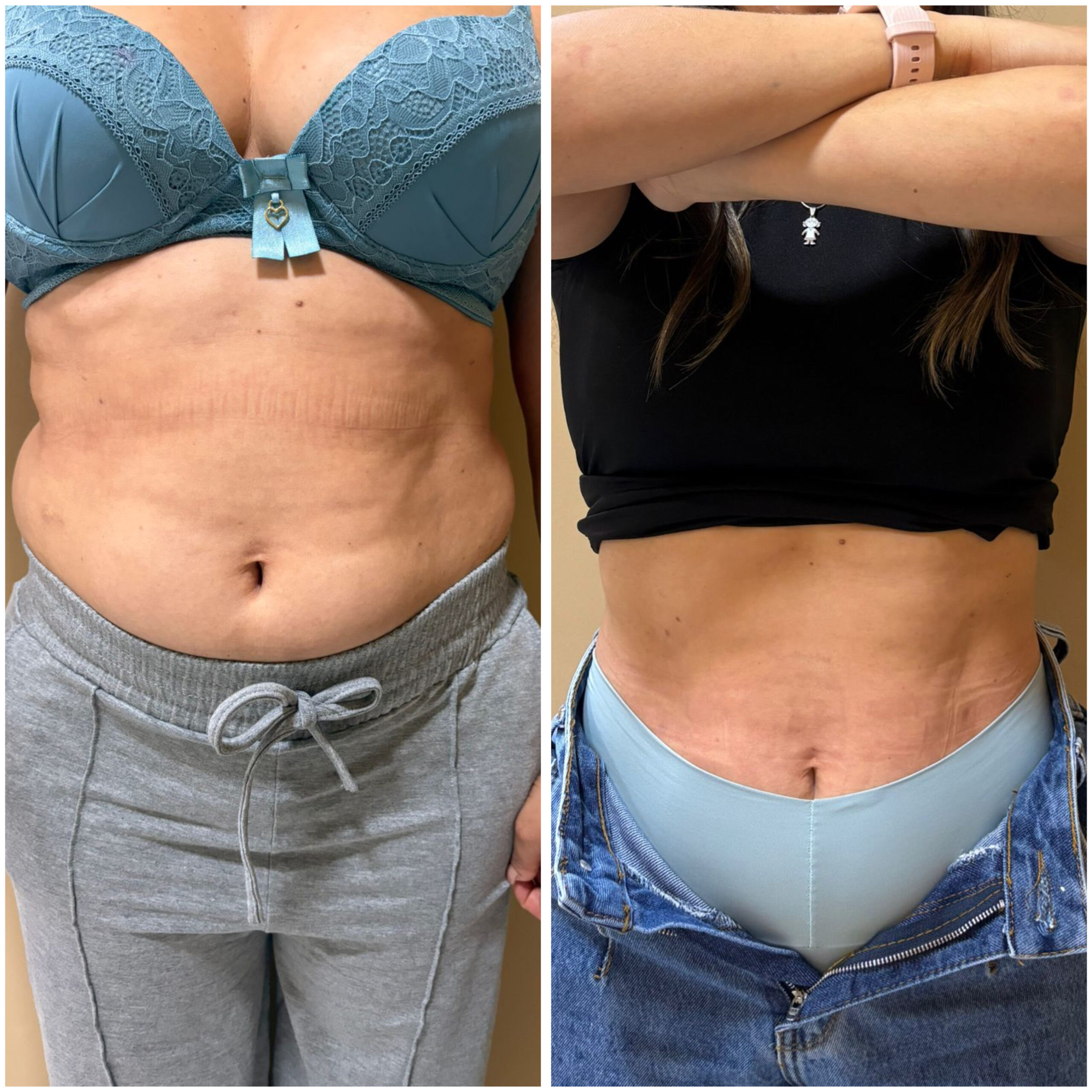 4FBBFB8B-BBEA-4BCB-9198-BC1355803636